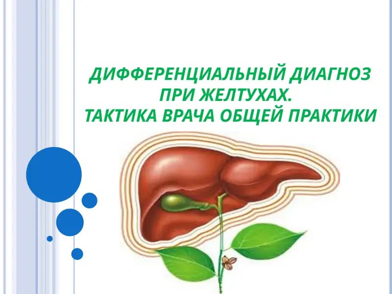 ДИФФЕРЕНЦИАЛЬНЫЙ ДИАГНОЗ ПРИ ЖЕЛТУХАХ. ТАКТИКА ВРАЧА ОБЩЕЙ ПРАКТИКИ