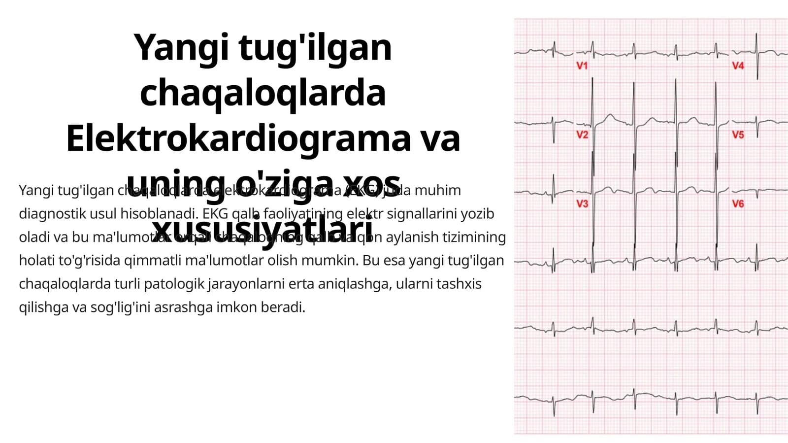Yangi tug'ilgan chaqaloqlarda Elektrokardiograma va uning o'ziga xos xususiyatlari