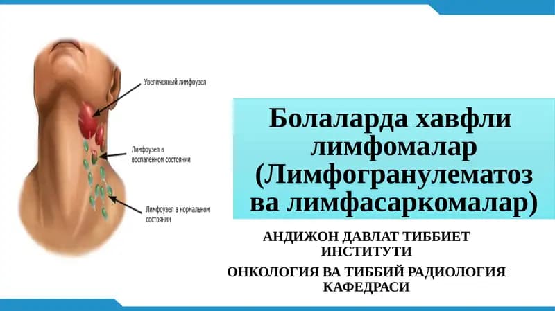 Болаларда хавфлилимфомалар(Лимфогранулематозвалимфасаркомалар)