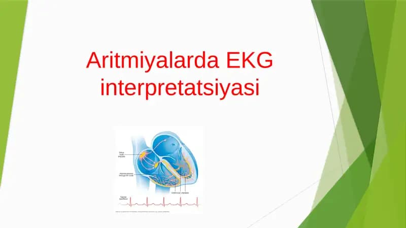 Aritmiyalarda EKG interpretatsiyasi