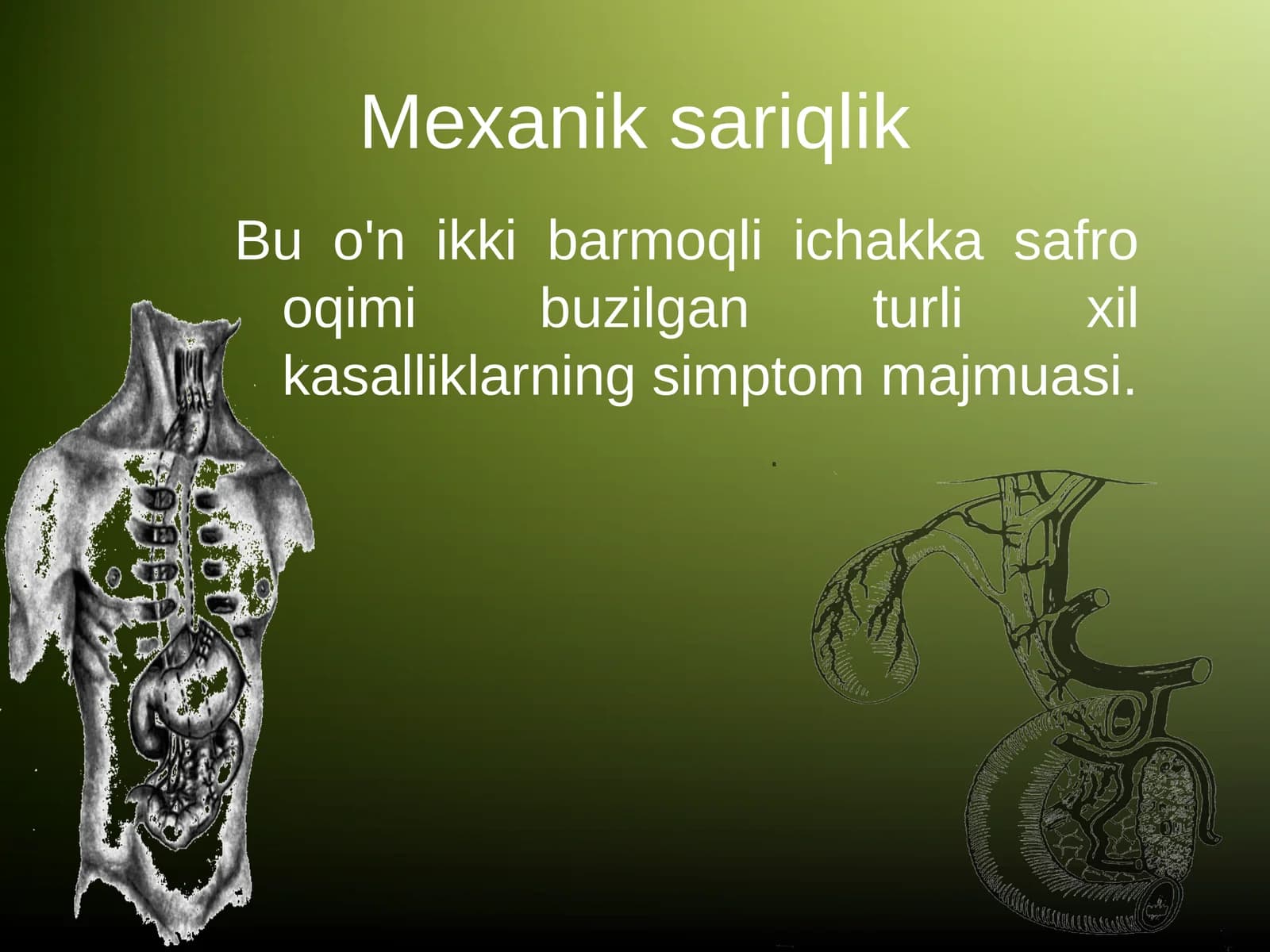 Mexanik sariqlik
