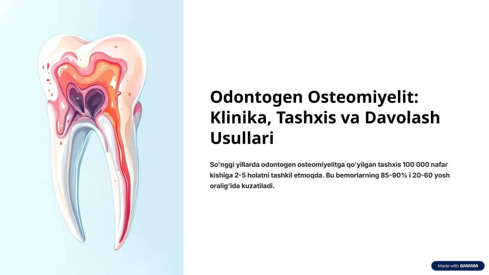 Odontogen Osteomiyelit: Klinika, Tashxis va Davolash Usullari