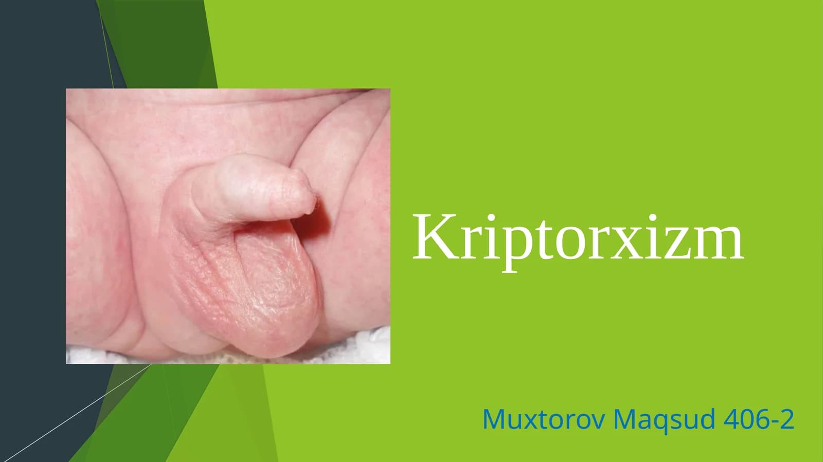 Kriptorxizm