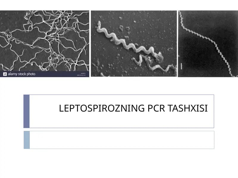 LEPTOSPIROZNING PCR TASHXISI