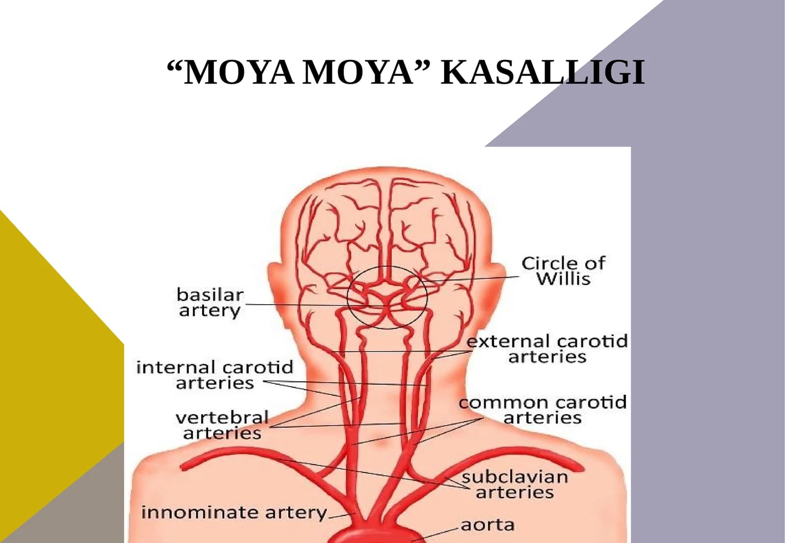 Moyamoya kasalligi