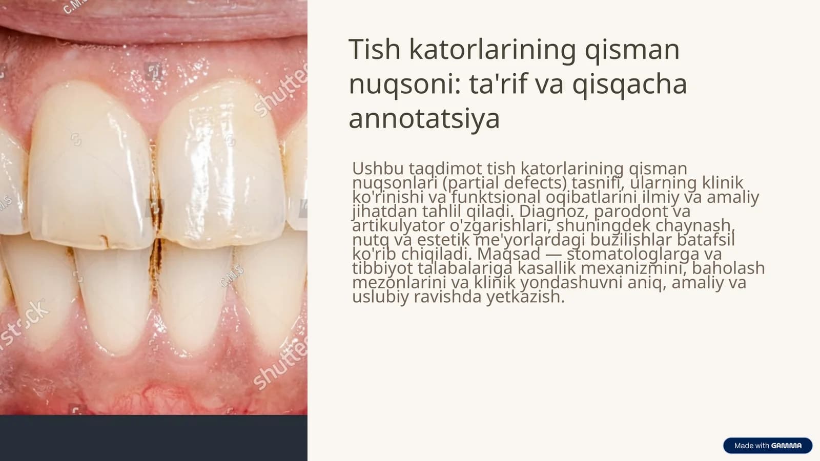 Tish qatorlarining qisman nuqsonlari