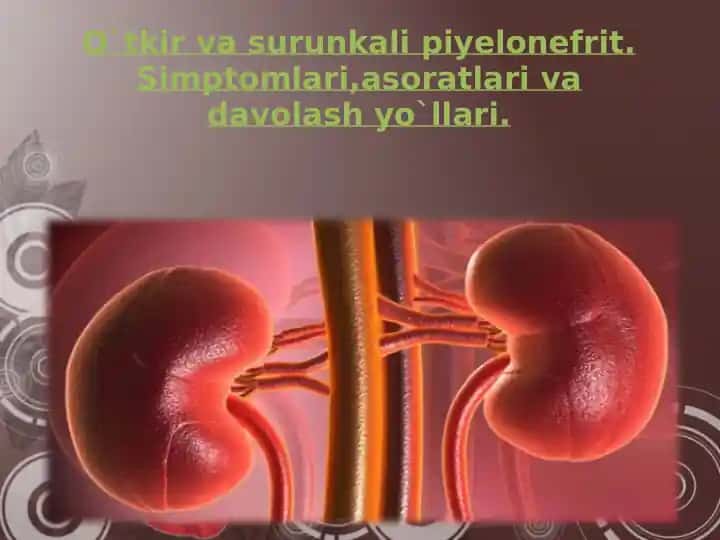 O`tkir va Surun Kali Pielonefrit