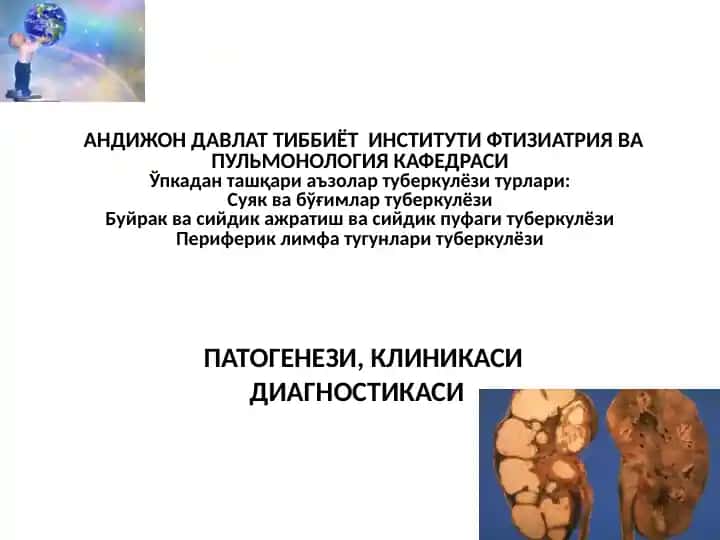 Ўпкадан ташқари аъзолар туберкулёзи: патогенези, клиникаси ва диагностикаси