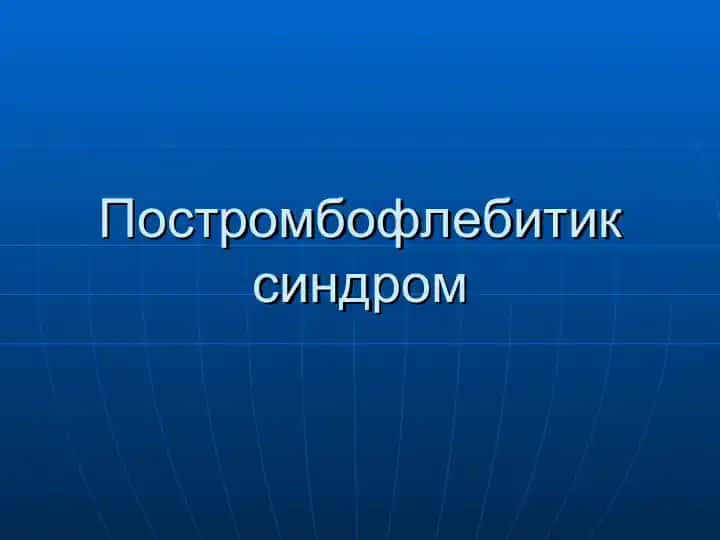 Постромбофлебитик синдром