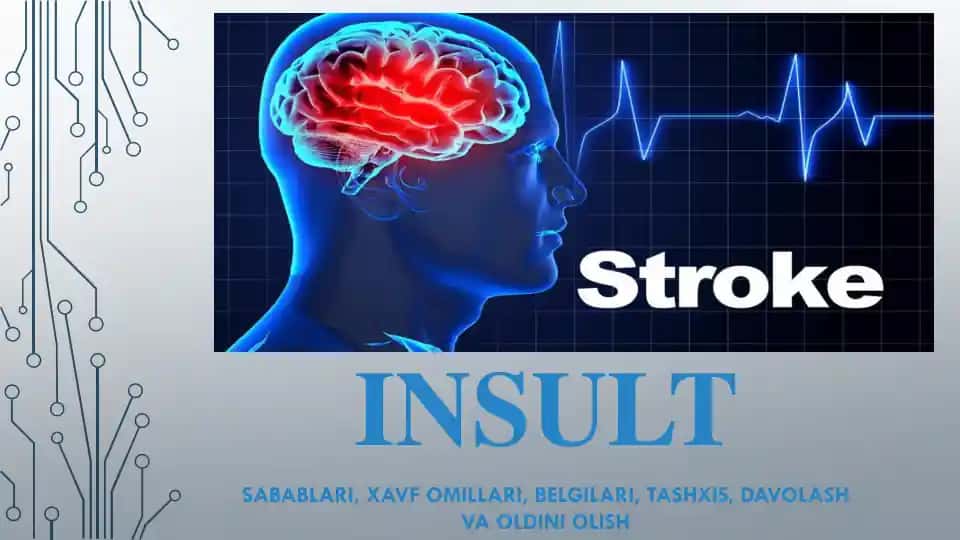 Gemorragik Insult va Ischemik Insult