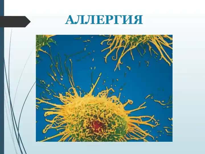 Allergiya
