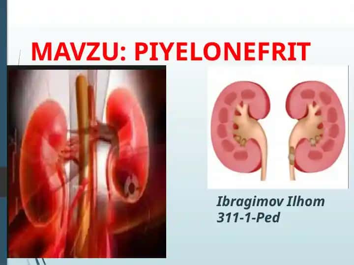 Piyelonefrit