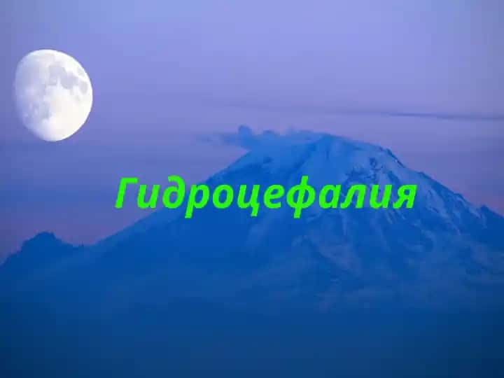 Гидроцефалия
