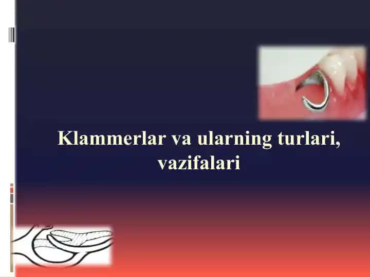 Klammerlar va ularning turlari, vazifalari
