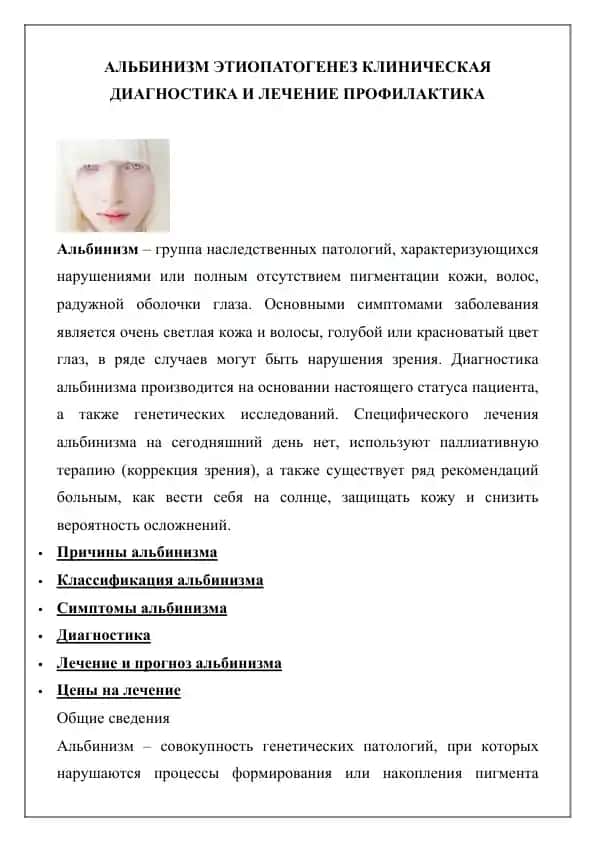 АЛЬБИНИЗМ ЭТИОПАТОГЕНЕЗ КЛИНИЧЕСКАЯ ДИАГНОСТИКА И ЛЕЧЕНИЕ ПРОФИЛАКТИКА