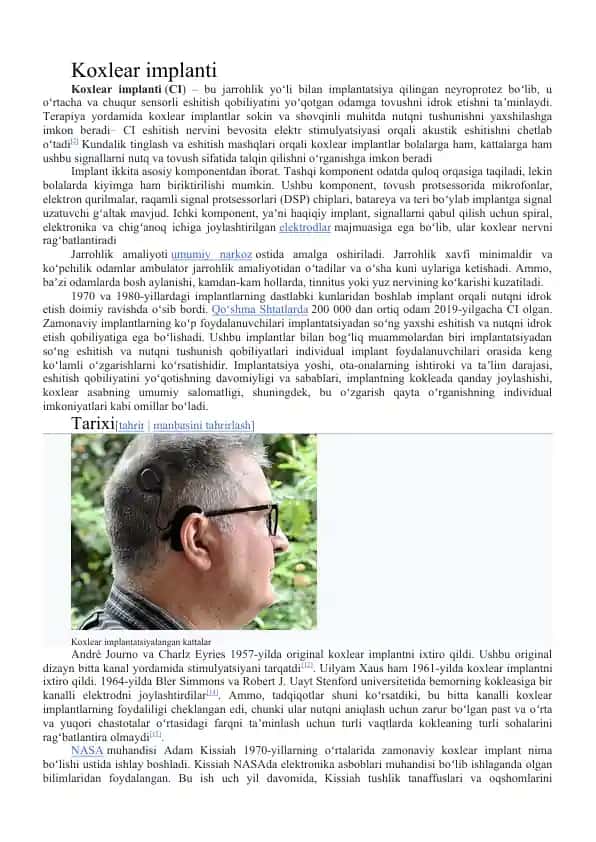 Koxlear implanti