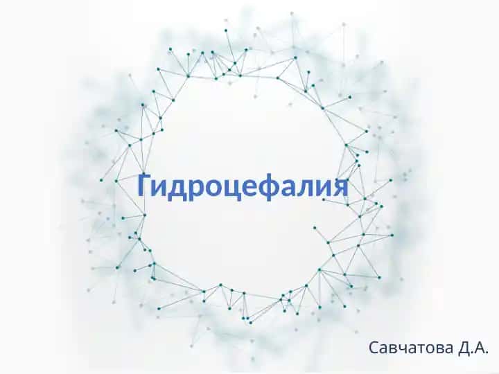 Гидроцефалия
