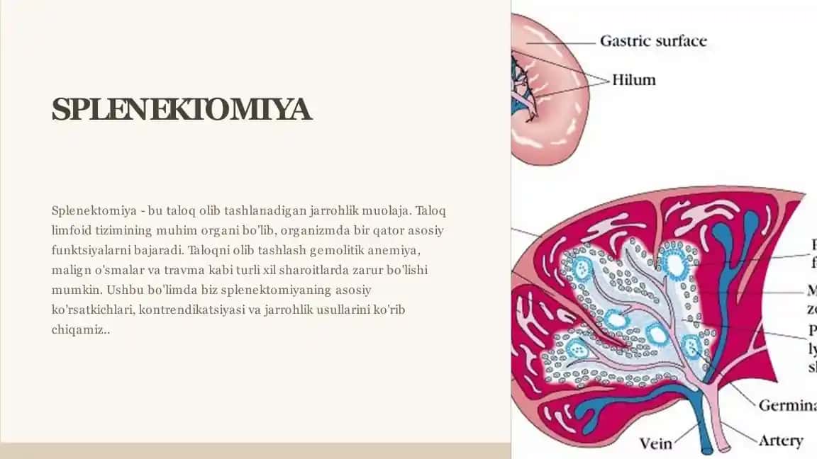 Splenektomiya