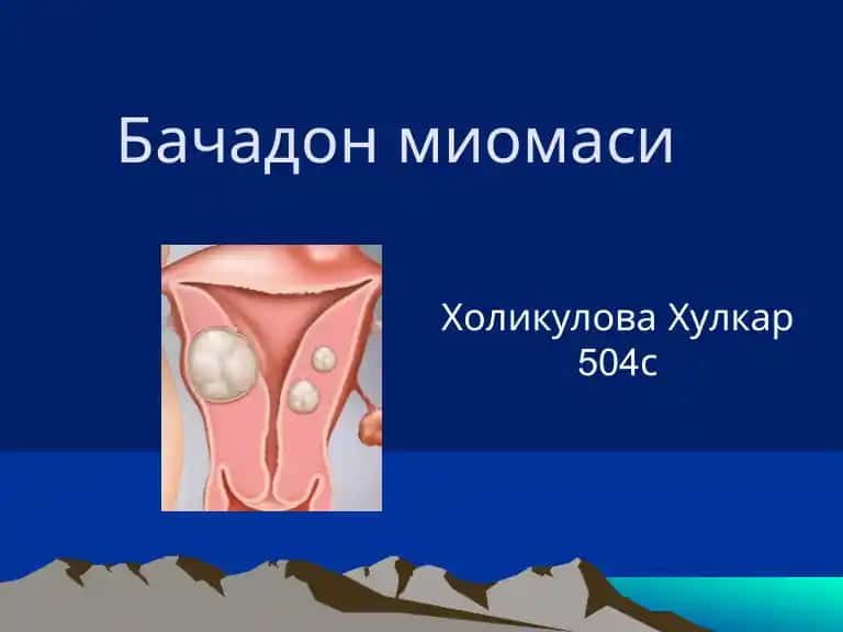Бачадон миомаси
