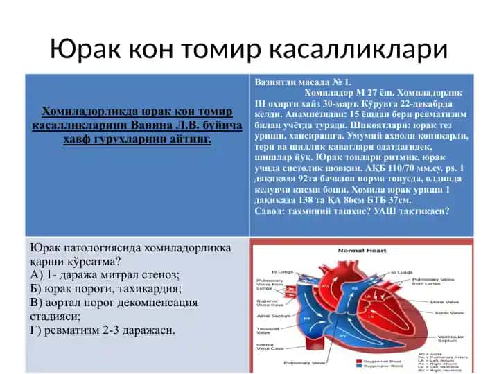 Юракконт томир касалликлари