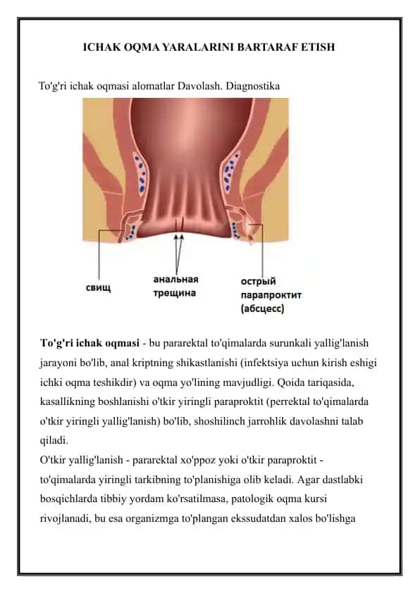 To'g'ri ichak oqmasi alomatlar Davolash. Diagnostika