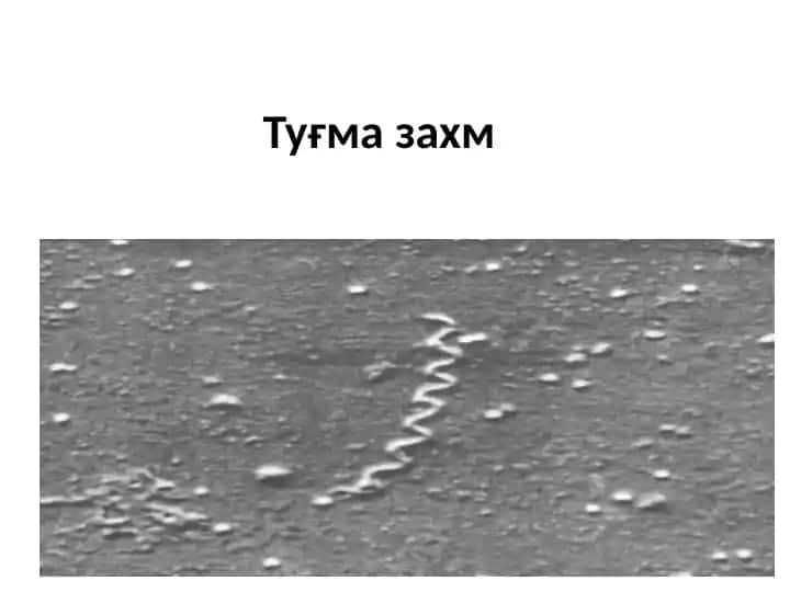 Туғмазахм