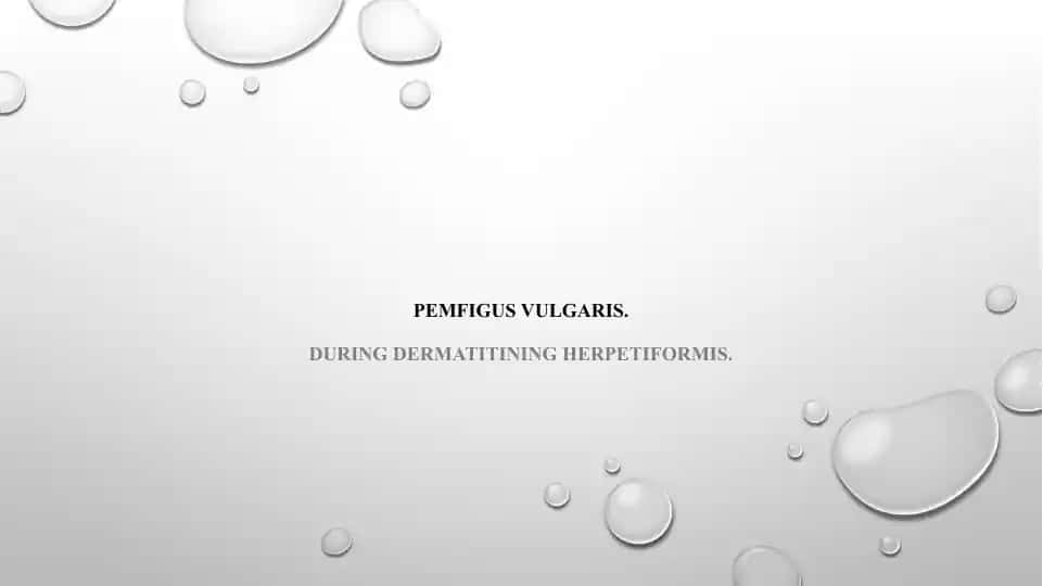 Pemfigus vulgaris