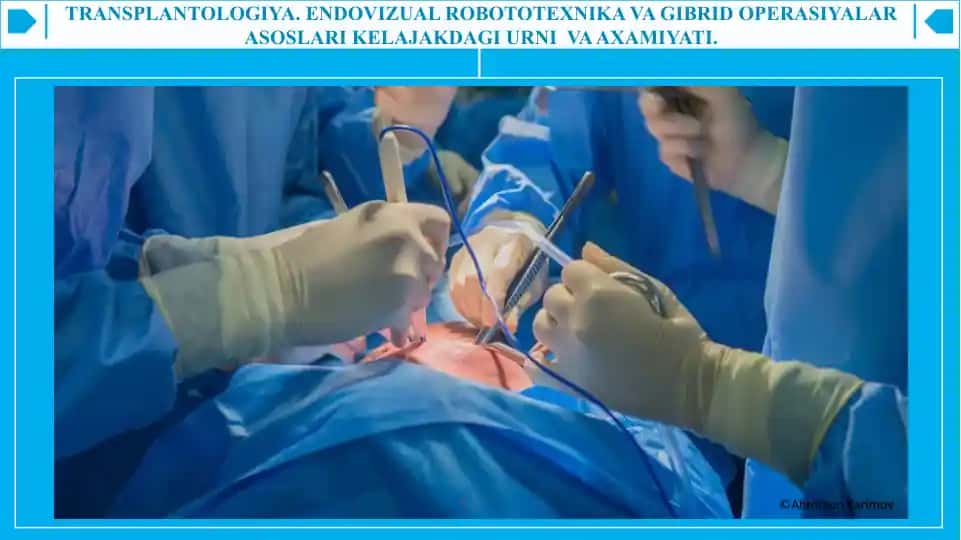 TRANSPLANTOLOGIYA. ENDOVIZUAL ROBOTOTEXNIKA VA GIBRID OPERASIYALAR ASOSLARI KELAJAKDAGI URNI VA AXAMIYATI