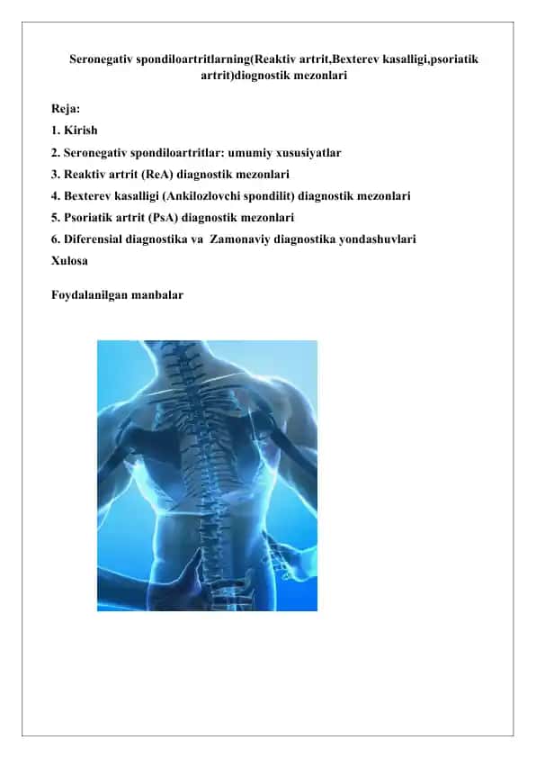 Seronegativ spondiloartritlarning(Reaktiv artrit,Bexterev kasalligi,psoriatik artrit)diognosti
