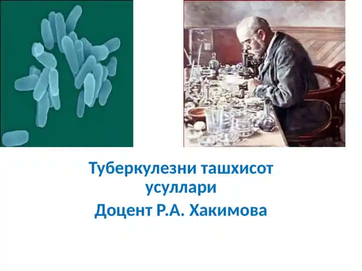 Tuberkulezni tashxisot usullari