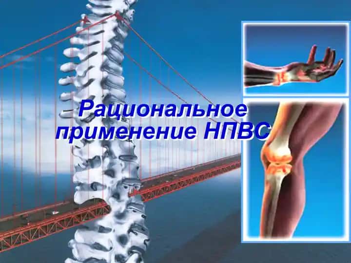 Рациональное применение НПВС