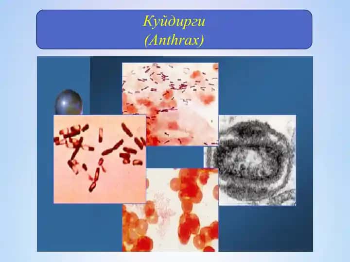 Куйдирги (Anthrax)
