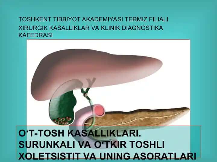 O‘T-TOSH KASALLIKLARI.SURUNKALI VA O‘TKIR TOSHLI XOLETSISTIT VA UNING ASORATLARI