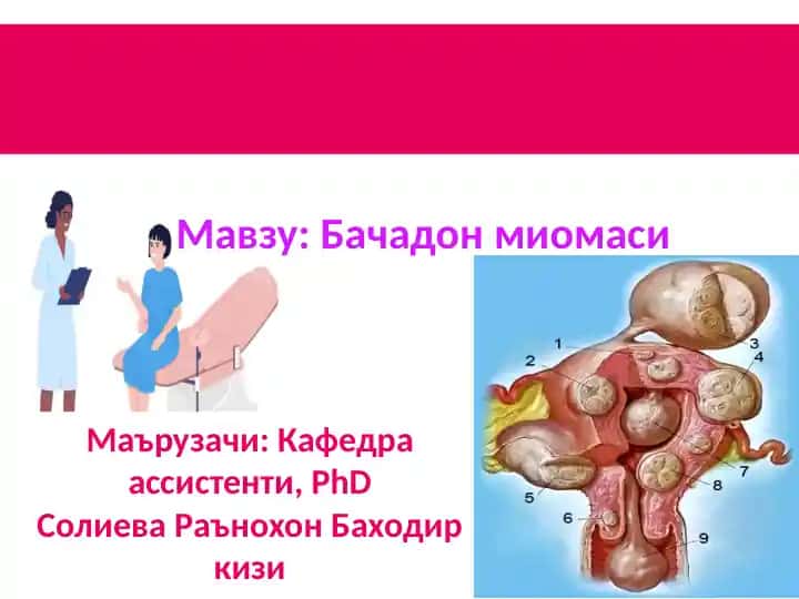 Бачадон миомаси