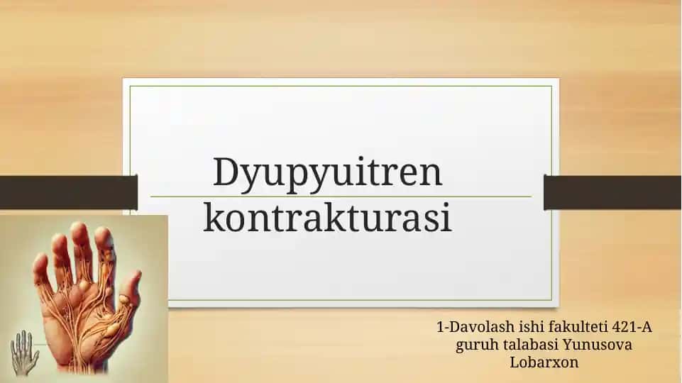 Dyupyuitrenkontrakturasi
