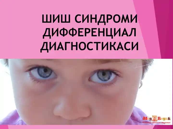 Шишсиндроми дифференциал диагностикаси
