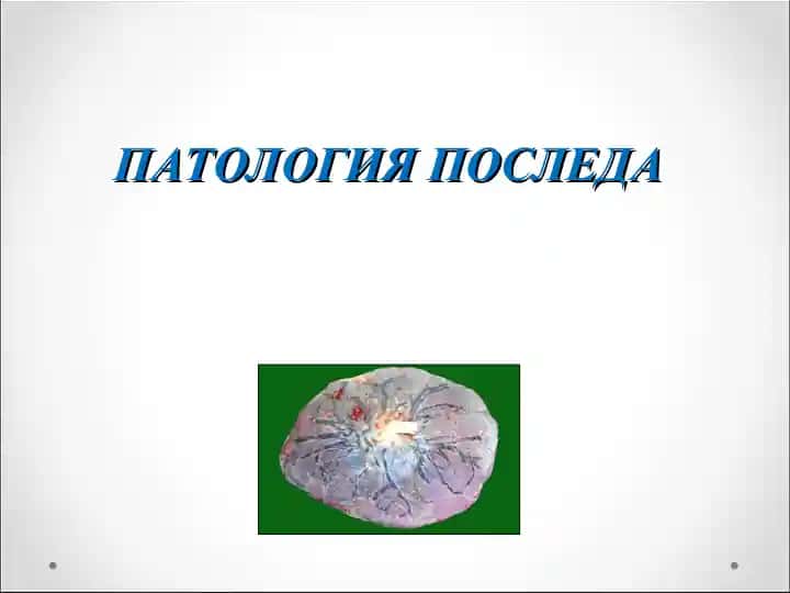 ПАТОЛОГИЯ ПОСЛЕДА