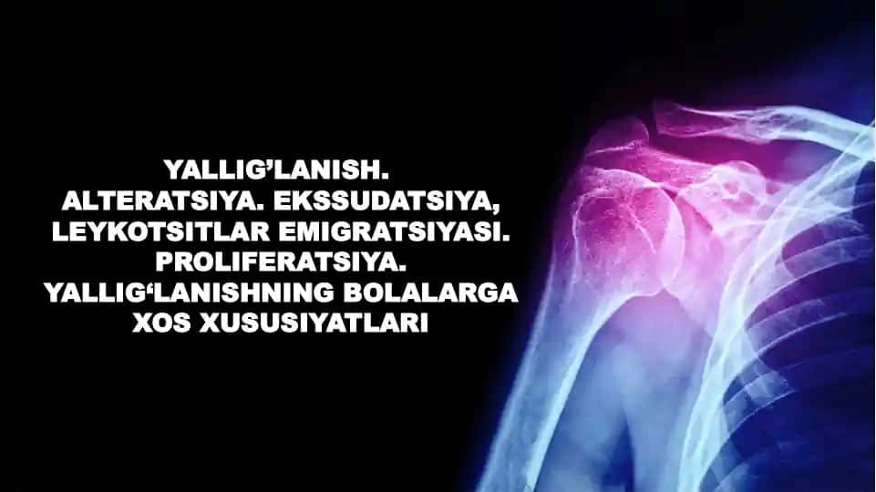 Yallig`lanish