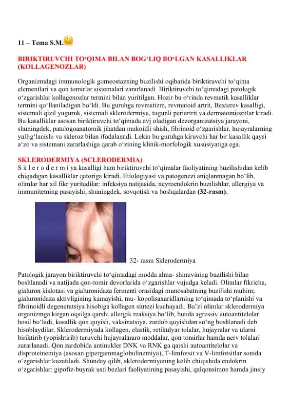 Biriktiruvchi To‘qima bilan Bog‘liq Bo‘lgan Kasalliklar (Kollagenozlar)