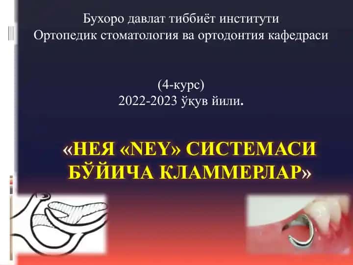 Нея «NEY» системаси бўйича кламмерлар