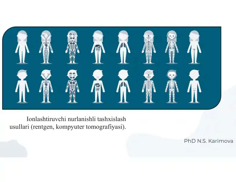Ionlashtiruvchi nurlanishli tashxislash usullari (rentgen, kompyuter tomografiyasi)