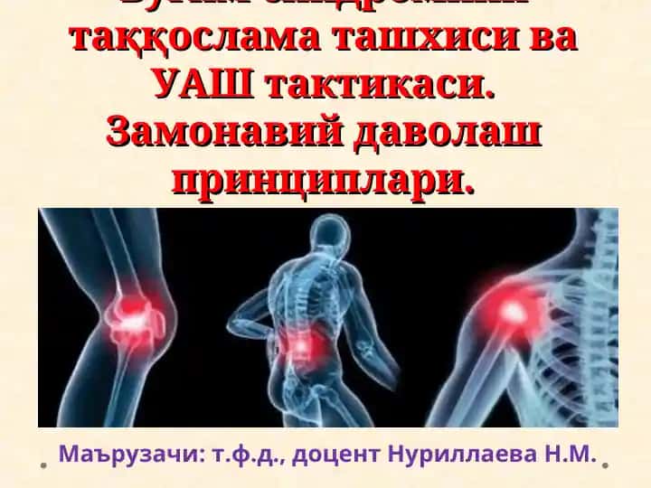 Буғим синдромини таққослама ташхиси ва УАШ тактикаси. Замонавий даволаш принциплари.