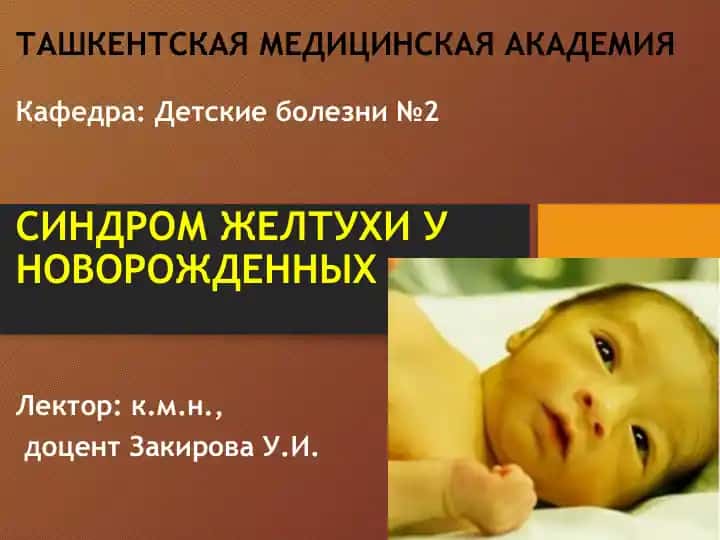 Синдром желтухи у новорожденных