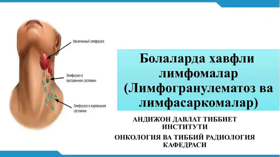 Болаларда хавфли лимфомалар (Лимфогранулематоз ва лимфасаркомалар)