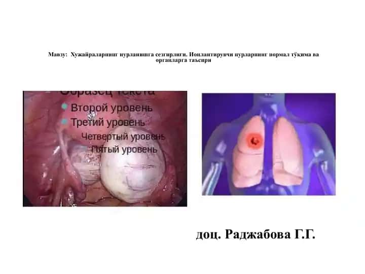 Radiatsion nurlanishning biologik tasiri