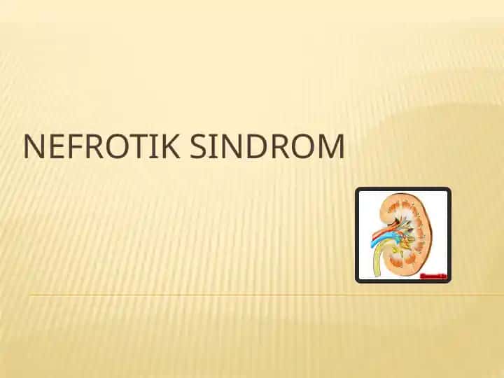 Nefrotik sindrom