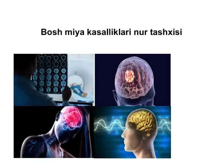 Bosh miya kasalliklari nur tashxisi