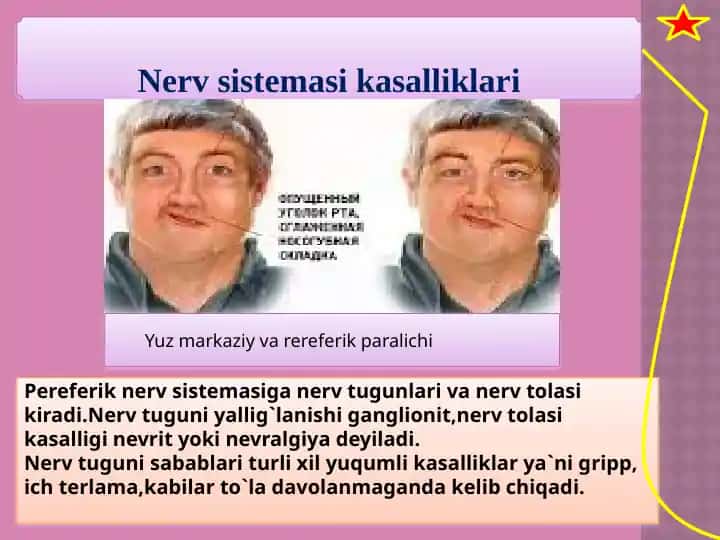 Nerv sistemasi kasalliklari