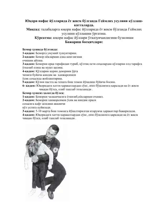 Геймлих усули