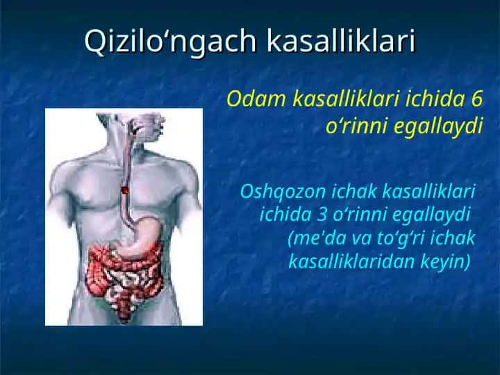 Qizilo‘ngach kasalliklari